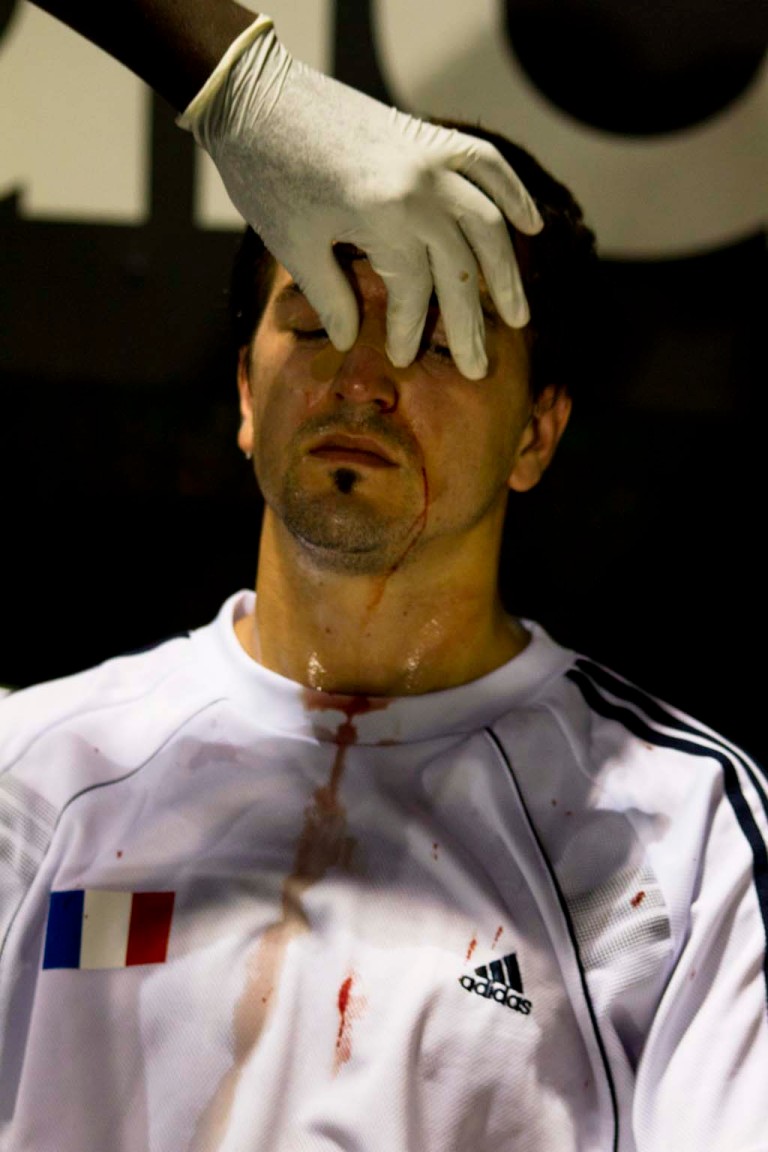Trio World Cup game broken nose French Player